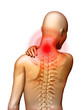 Neck pain