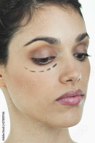 Photo: Closeup of patient's face with distance marker Closeup of patient's face with distance marker