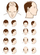 hair loss