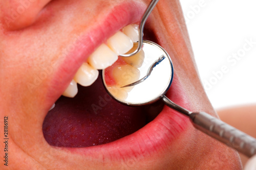 Photo: A young woman / teenager with open mouth at the dentist A young woman / teenager with open mouth at the dentist