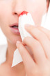 blood nose blood nose