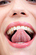 Foto: To Grimace To Grimace