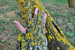 bark skin