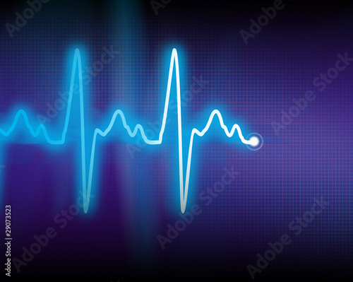 Illustration: cardiogram cardiogram