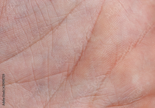 Photo: skin skin
