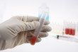 blood in tube