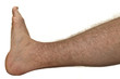 Photo: Hairy leg Hairy leg