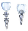 Dental implant 3d crown with pin isolated on white