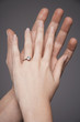 Young couple with hands raised together showing woman's engagement ring, close up on hands