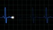 EKG