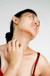 Woman neck and face with skin rash Woman neck and face with skin rash