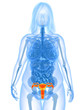 übergewichtige Frau - markierter Uterus übergewichtige Frau - markierter Uterus