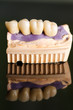 Dental bridge made of porcelain on casting