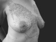 Women