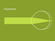 Schema Hyperopie