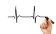 Drawing ECG