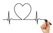 Drawing ECG line