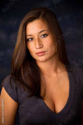 Photo: Freckled Asian American Freckled Asian American