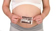 Pregnant woman showing us scan of her futur baby