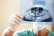 Dentist Examining X-Ray