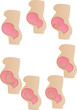 Vector illustration stages of development of a germ Vector illustration stages of development of a germ