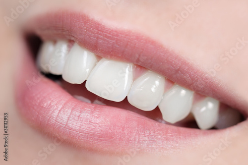 Photo: Close up of white, shiny and healthy smile Close up of white, shiny and healthy smile