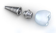 Dental implant lying on surface top side view isolated on white