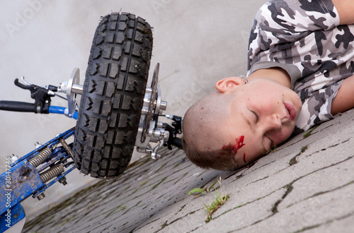 Photo: Boy after accident Boy after accident