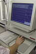 Photo: EKG monitor EKG monitor