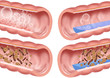 bowels