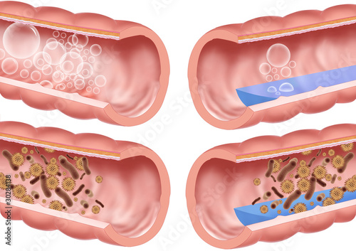 Illustration: bowels bowels