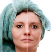 Foto: Woman with spotty skin with deep pores and healed soft skin Woman with spotty skin with deep pores and healed soft skin