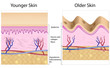 Wrinkled skin versus smooth skin