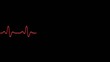 EKG