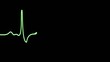 Video: ECG ECG