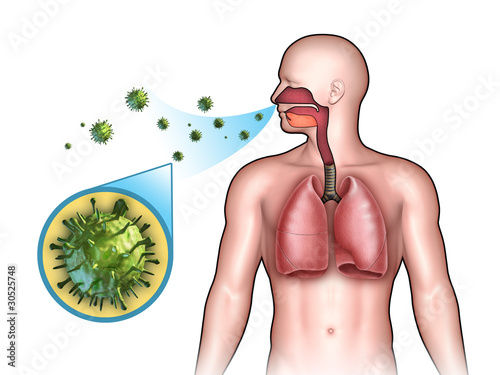 Illustration: Viral infection Viral infection