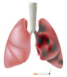Smoker's lung (with cancer) versus healthy lung, eps8
