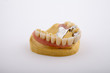 denture teeth
