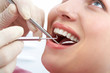 Examining mouth