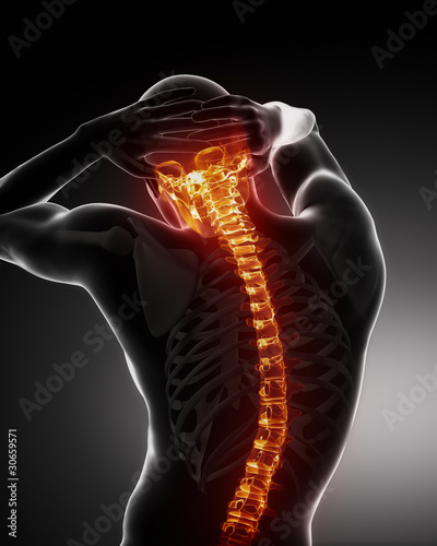 Photo: Male Body Cervical Backbone pain scan Male Body Cervical Backbone pain scan