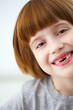 Foto: Closeup portrait of a cute smiling girl missing front teeth Closeup portrait of a cute smiling girl missing front teeth