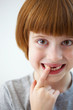 Photo: Closeup portrait of a cute smiling girl missing front teeth Closeup portrait of a cute smiling girl missing front teeth