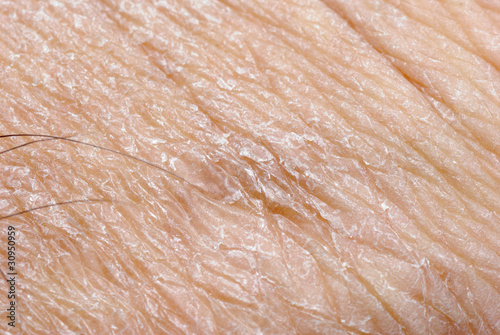 Photo: dry skin texture dry skin texture