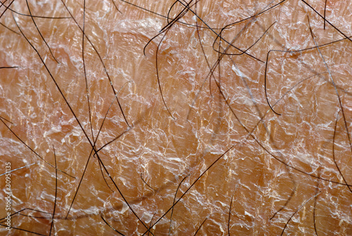 Photo: dry skin texture dry skin texture