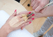 hand skin treatment hand skin treatment