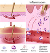 Leukocytes role in inflammation, eps8