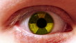 Video: Radiation sign in eye Radiation sign in eye