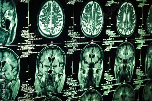 Photo: Very sharp scan of the human brain in green Very sharp scan of the human brain in green