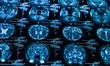 sharp ct scan of the human brain