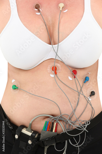 Photo: Woman Wearing Holter To Monitor Heart Activity Woman Wearing Holter To Monitor Heart Activity